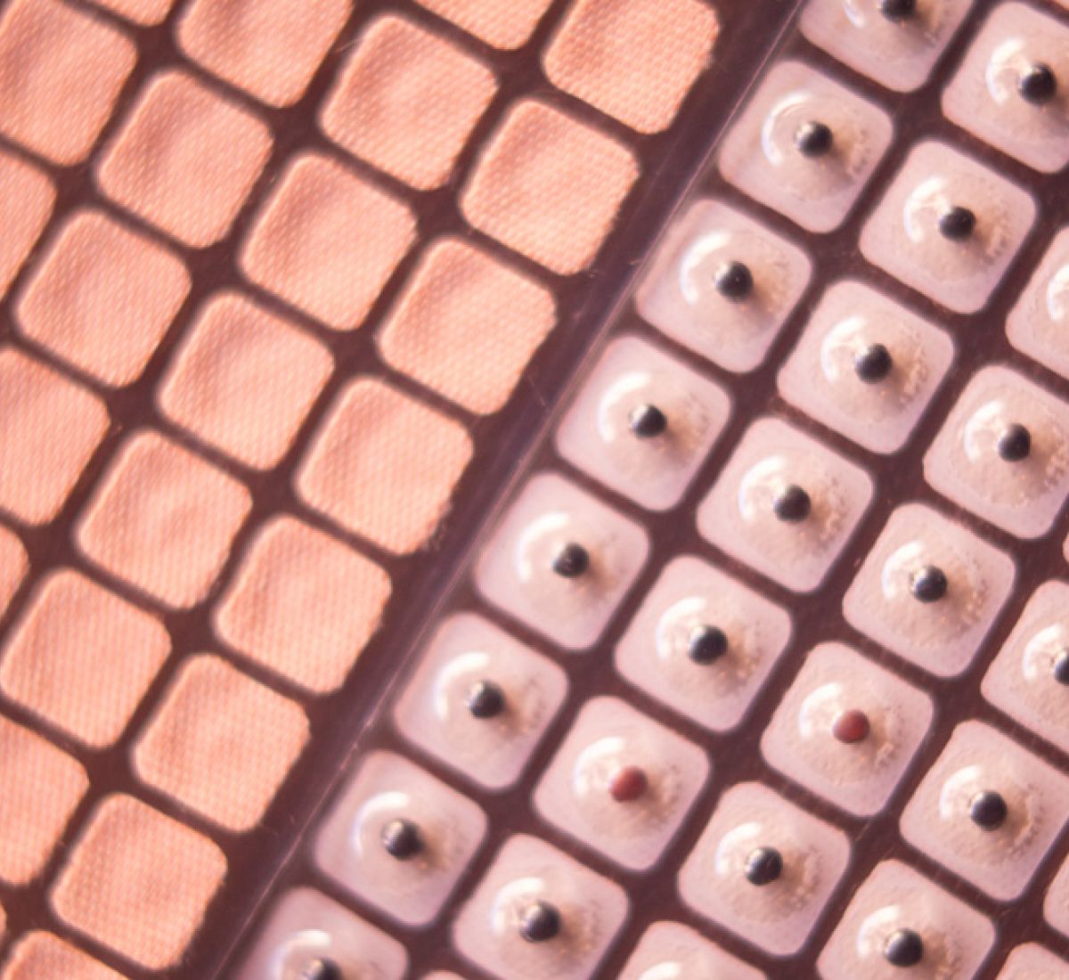 SinoQi TCM Zürich - Ohrakupunktur 2